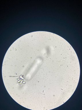 Microscopic view of struvite crystals from urinary sediment. Magnesium ammonium phospate crystals. Causing Feline Lower Urinary Tract Disease