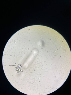 Microscopic view of struvite crystals from urinary sediment. Magnesium ammonium phospate crystals. Causing Feline Lower Urinary Tract Disease