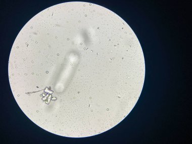 Microscopic view of struvite crystals from urinary sediment. Magnesium ammonium phospate crystals. Causing Feline Lower Urinary Tract Disease