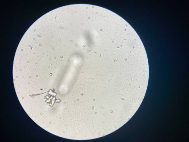 Microscopic view of struvite crystals from urinary sediment. Magnesium ammonium phospate crystals. Causing Feline Lower Urinary Tract Disease