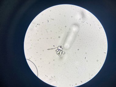 Microscopic view of struvite crystals from urinary sediment. Magnesium ammonium phospate crystals. Causing Feline Lower Urinary Tract Disease
