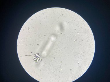 Microscopic view of struvite crystals from urinary sediment. Magnesium ammonium phospate crystals. Causing Feline Lower Urinary Tract Disease