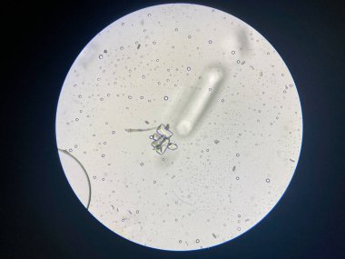 Microscopic view of struvite crystals from urinary sediment. Magnesium ammonium phospate crystals. Causing Feline Lower Urinary Tract Disease