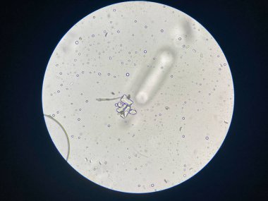 Microscopic view of struvite crystals from urinary sediment. Magnesium ammonium phospate crystals. Causing Feline Lower Urinary Tract Disease