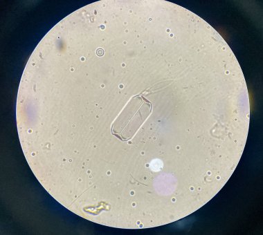 Microscopic view of struvite crystals from urinary sediment. Magnesium ammonium phospate crystals. Causing Feline Lower Urinary Tract Disease
