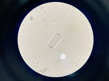 Microscopic view of struvite crystals from urinary sediment. Magnesium ammonium phospate crystals. Causing Feline Lower Urinary Tract Disease