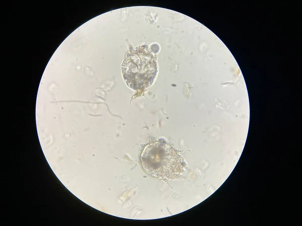 Notoedres Cati Κάτω Από Μικροσκόπιο Notoedric Mage Επίσης Γνωστό Feline — Φωτογραφία Αρχείου