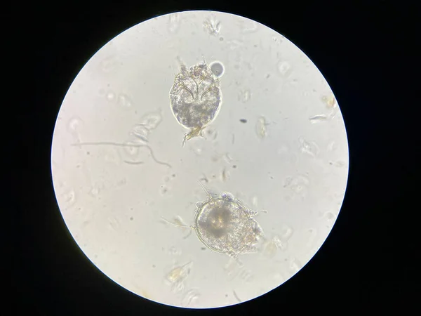 Notoedres Cati Bajo Microscopio Sarna Notoédrica También Conocida Como Sarna —  Fotos de Stock