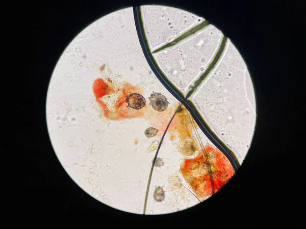 Notoedres Cati Pod Mikroskopem Notoedric Svrabu Také Nazývané Feline Strupy — Stock fotografie