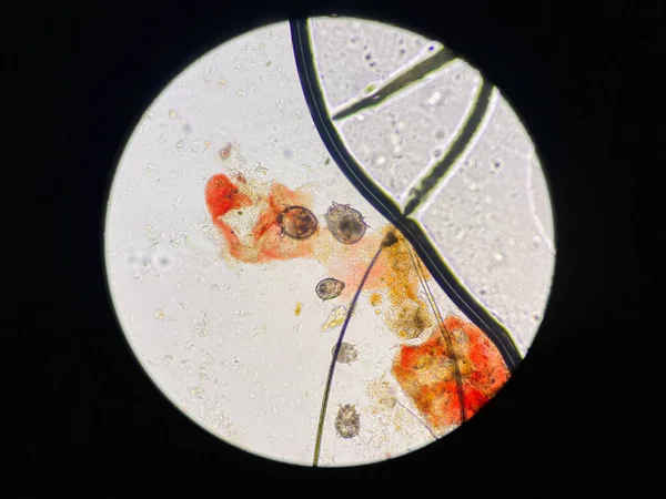 Notoedres Cati Bajo Microscopio Sarna Notoédrica También Conocida Como Sarna — Foto de Stock