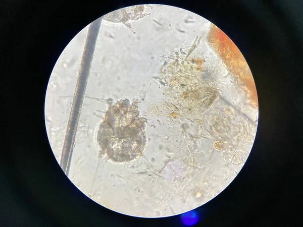 Notoedres Cati Microscópio Notoedric Mange Também Conhecido Como Sarna Felina — Fotografia de Stock