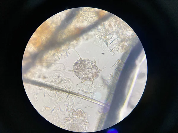 Notoedres Cati Mikroskop Altında Notoedric Uyuz Notoedric Uyuz Olarak Bilinir — Stok fotoğraf