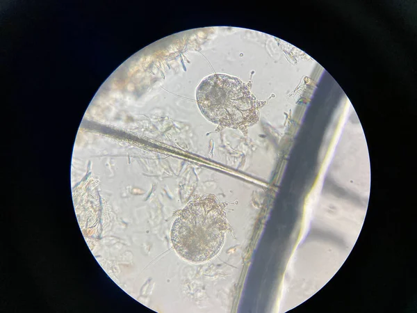 Notoedres Cati Mikroskop Altında Notoedric Uyuz Notoedric Uyuz Olarak Bilinir — Stok fotoğraf
