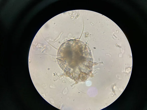 顕微鏡下のダニに注意してください 微生物 Fine Scabes とも呼ばれるNotedric Mangeは 真菌と皮膚がダニを燃焼させることによって引き起こされる感染性の高い皮膚感染症です — ストック写真