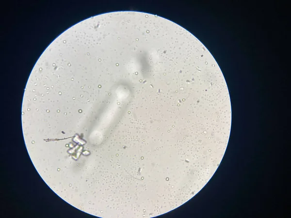 Microscopic View Struvite Crystals Urinary Sediment Magnesium Ammonium Phospate Crystals — 스톡 사진
