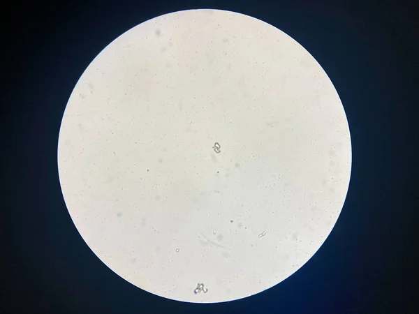Microscopic View Struvite Crystals Urinary Sediment Magnesium Ammonium Phospate Crystals — Foto de Stock