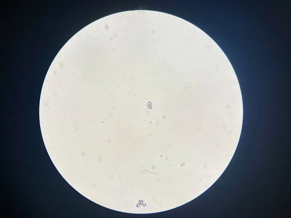 Microscopic View Struvite Crystals Urinary Sediment Environ Cristaux Phosphates Ammonium — Photo