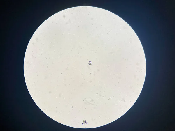 Microscopic View Struvite Crystals Urinary Sediment Magnesium Ammonium Phospate Crystals — ストック写真