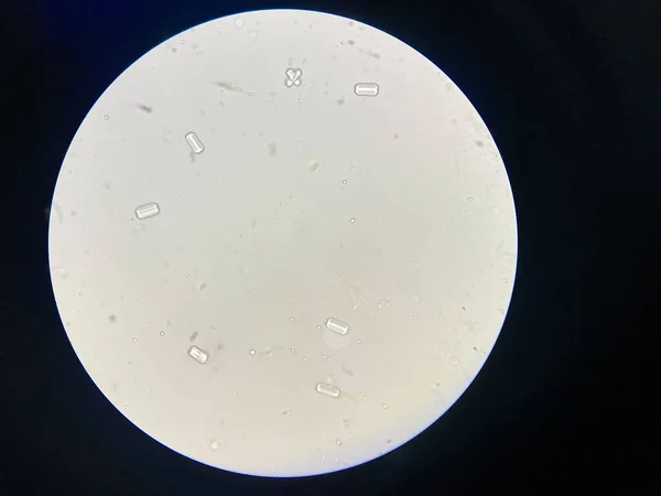 尿沉渣中柱状晶体的显微观察 磷酸铵晶体镁 引起Feline下尿道疾病 — 图库照片