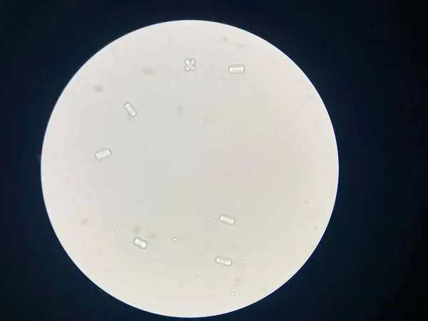 Mikroskopischer Blick Auf Struvitkristalle Aus Harnsedimenten Magnesiumammoniumphosphat Kristalle Verursacht Bei — Stockfoto