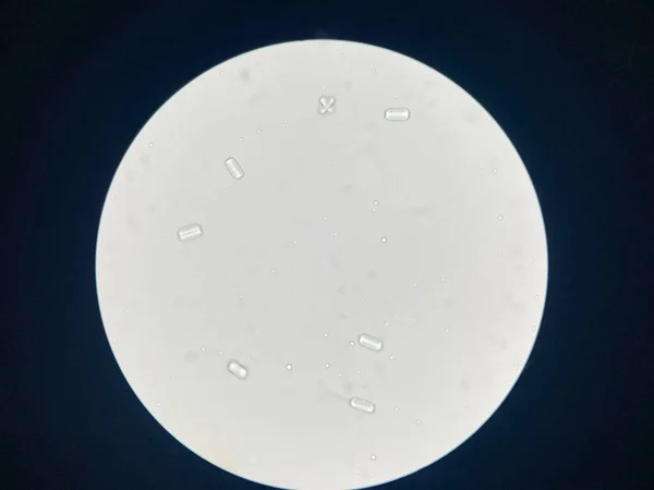 Microscopic View Struvite Crystals Urinary Sediment Magnesium Ammonium Phospate Crystals — Stok fotoğraf