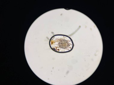 Otodectes cynotis, or ear mites under the microscope. This mites are found in cat's ear.