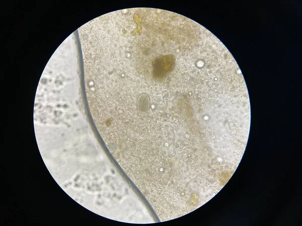 Hook Worm Eggs Parasite Stool Examination — Stock Photo, Image