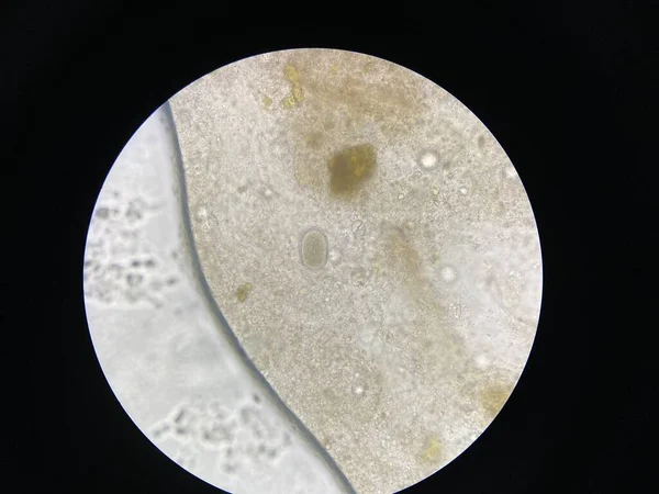Hook Worm Eggs Parasite Stool Examination — Stock Photo, Image