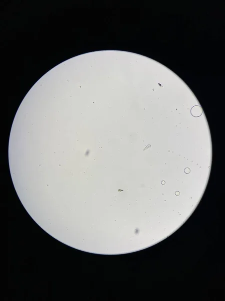 Mikroskopický Pohled Krystaly Struvitu Močového Sedimentu Krystaly Fosforečnanu Hořečnatého Způsobuje — Stock fotografie