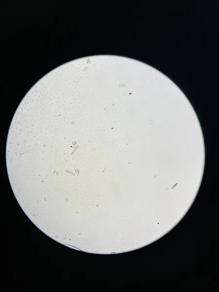 尿沉渣中柱状晶体的显微观察 磷酸铵晶体镁 引起Feline下尿道疾病 — 图库照片