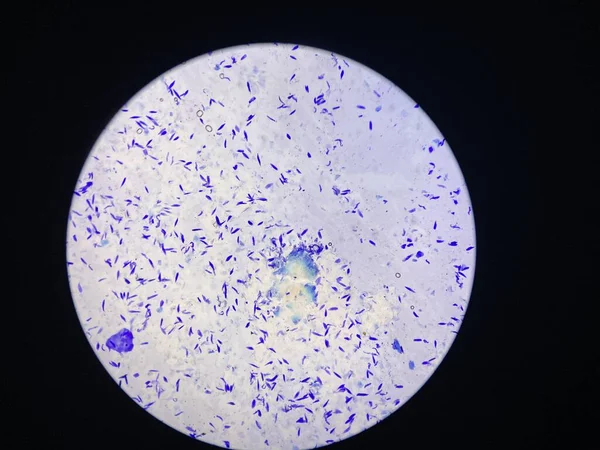 Résultats Examen Peau Avec Coloration Simple Sous Microscope Des Cellules — Photo