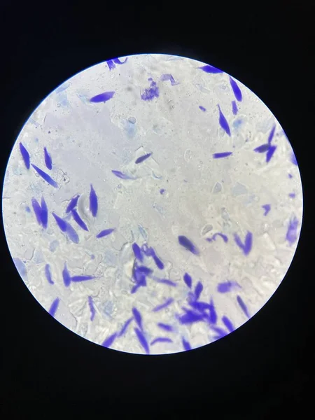 在显微镜下简单染色的皮肤检查结果 可见炎症性细胞和细胞碎片 — 图库照片