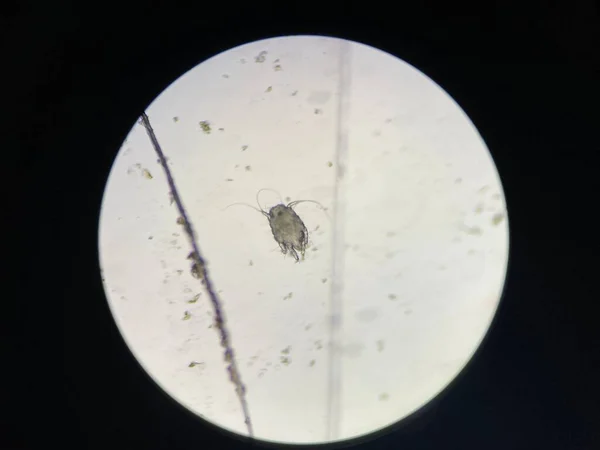 Otodectes Cynotis Ear Mites Microscope Mites Found Cat Ear — Foto Stock