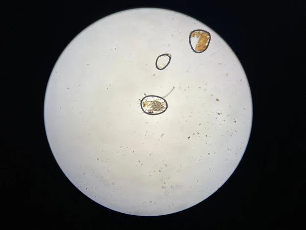 Otodectes Cynotis Ear Mites Microscope Mites Found Cat Ear — стоковое фото