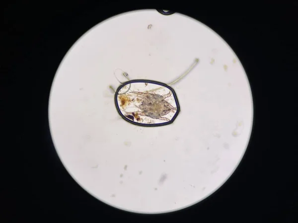 Otodectes Cynotis Ear Mites Microscope Mites Found Cat Ear — Stock fotografie