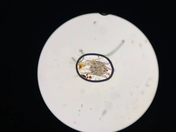 Otodectes Cynotis Ear Mites Microscope Mites Found Cat Ear — 스톡 사진