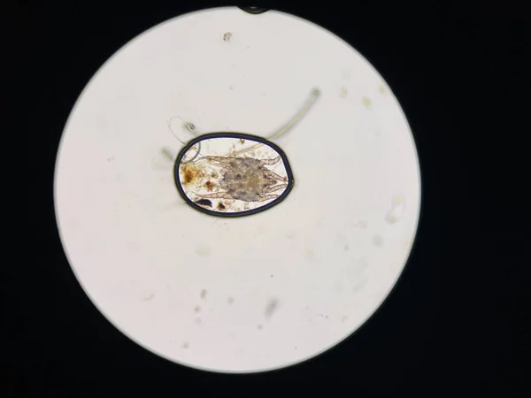 Otodectes Cynotis Ear Mites Microscope Mites Found Cat Ear — Fotografia de Stock
