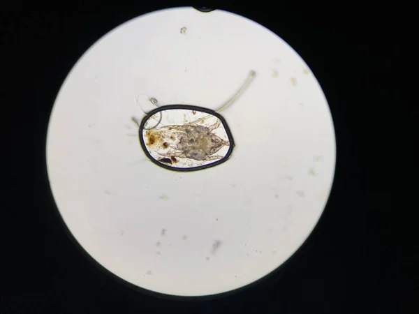 Отодективує Циніти Або Вушні Кліщі Під Мікроскопом Кліщі Знайдені Вусі — стокове фото