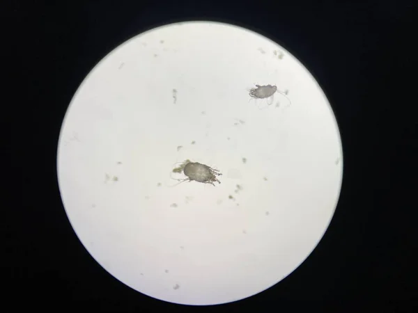 Otodectes Cynotis Ear Mites Microscope Mites Found Cat Ear — Stock Photo, Image
