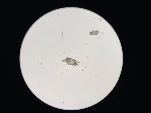 Otodectes Cynotis Ear Mites Microscope Mites Found Cat Ear — ストック写真
