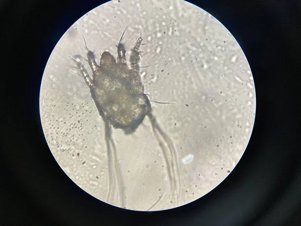 Otodectes Cynotis Ear Mites Microscope Mites Found Cat Ear — Stok fotoğraf
