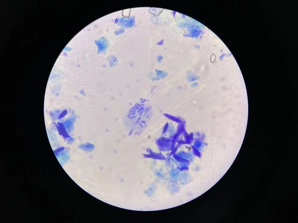 単純な汚れを有する炎症性細胞および細菌の顕微鏡的な眺め — ストック写真