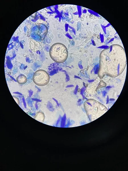 Risultati Esame Della Pelle Con Colorazione Semplice Microscopio Osservano Cellule — Foto Stock