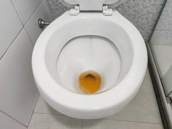 Badezimmer Toilette Mit Dunklem Urin — Stockfoto