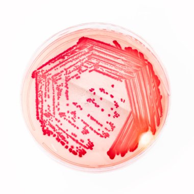 Helicobacter pylori, bacteria that infects the stomach - Bacterial culture