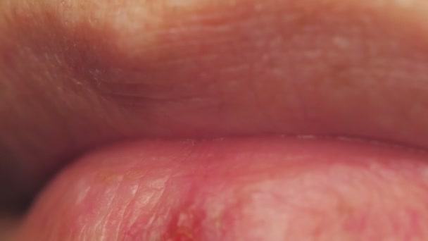 Lips Close Cold Lips Womens Lips Wound Macro Video High — Stock Video