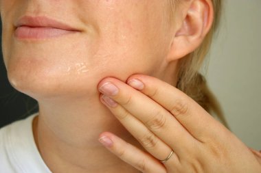 Yüzünde nemlendirici cilt serumu ve sivilce izleri olan bir kadın.