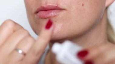 Kırmızı virüslü uçuğa beyaz krem süren bir kadının yakın plan görüntüsü.