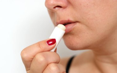 Kırmızı virüslü uçuklara dudak kremi süren, bulanık beyaz arka plan.
