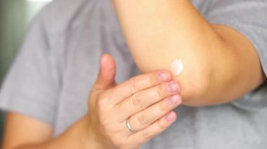 Dirseğine beyaz krem sürerken kadın elini kapat. Soğuk mevsim ve kuru deri. Güzellik ve vücut bakımı kavramı